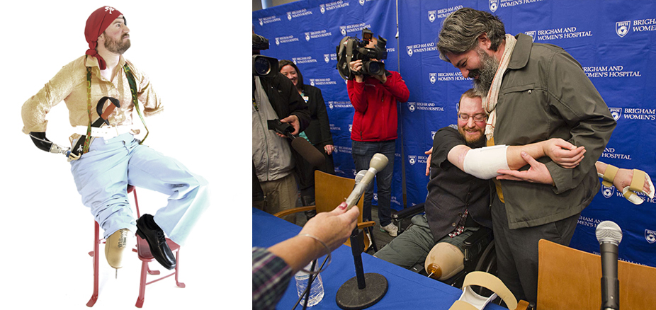 Left: Will dressed up as a funky pirate. Photo by Asia Kepka. Right: Will hugs Angel at a press conference. Photo courtesy of Brigham and Women's Hospital