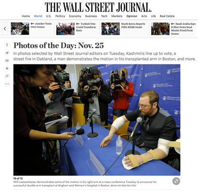 Wall Street Journal's 'Photo of the Day' features Will Lautzenheiser at a press conference at the Brigham and Women's Hospital. Photo by Brian Snyder/REUTERS